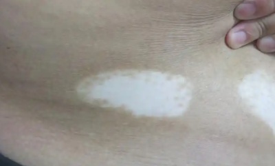 phpvcxIOh
