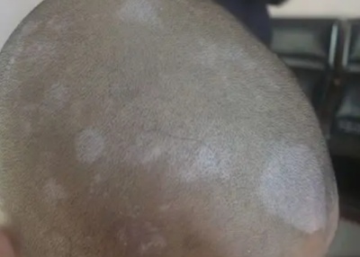 phpeMxO2M